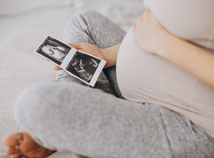pregnancy scan