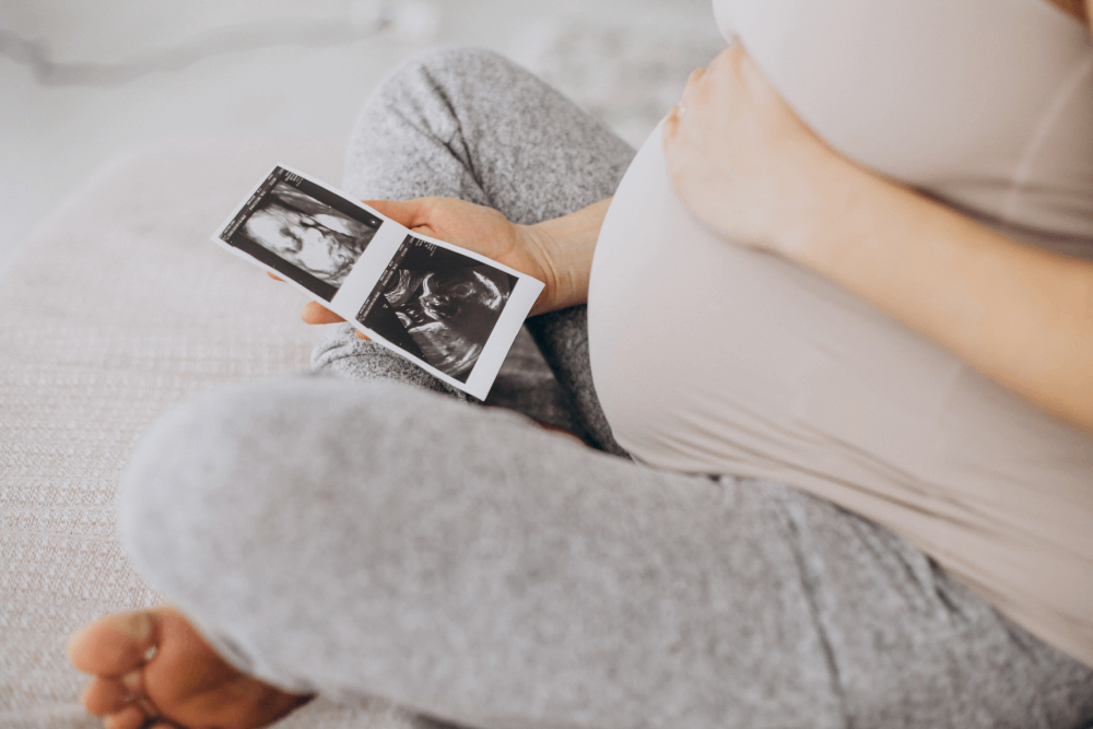 pregnancy scan